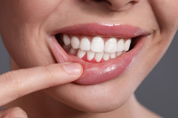 How Does A Dentist Approach Gum Disease Treatment?