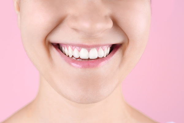 Are Teeth Bleaching And Whitening The Same?